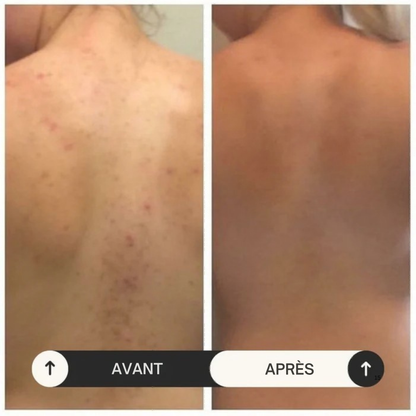 Serviette Exfoliante Corps Samaya