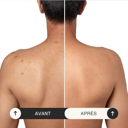 Serviette Exfoliante Corps Samaya